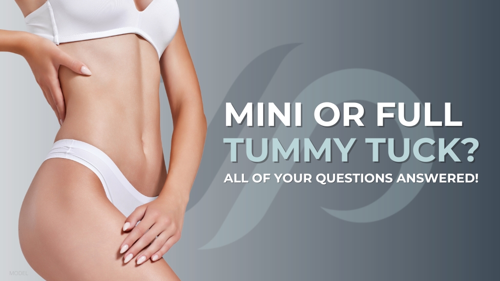 Woman in white underwear (MODEL- "MINI OR FULL TUMMY TUCK? ALL OF YOUR QUESTIONS ANSWERED!"