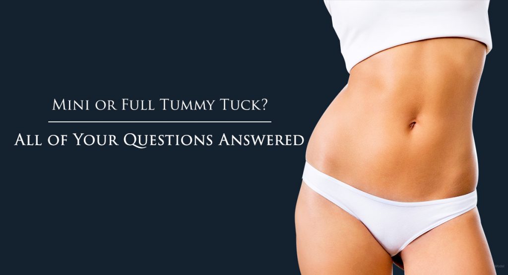 Dr. Parker Talks Tummy Tucks: Figuring Out a Treatment Plan for Top-Notch  Results