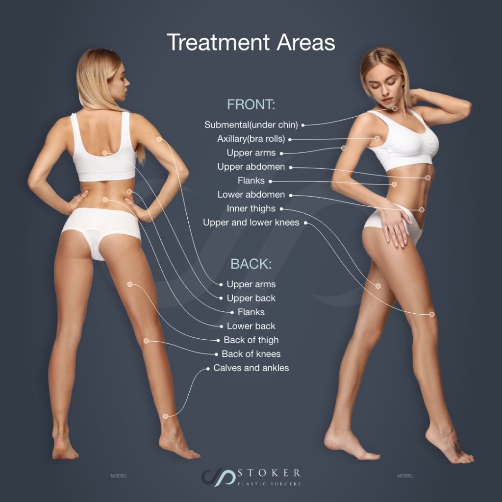 Exploring the Different Types of Arm Liposuction to Achieve Desired Results  - Atlanta Liposuction Specialty Clinic