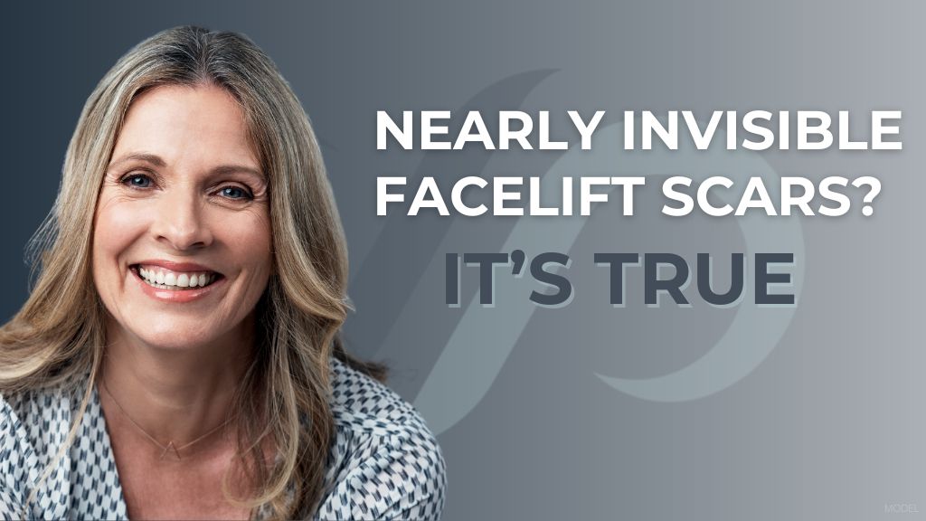 Nearly Invisible Facelift Scars? It's True (with model image of a smiling mature woman)