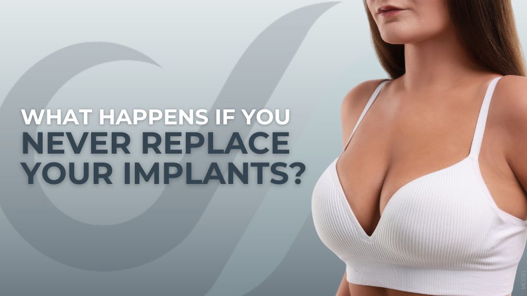 Model image of a woman wearing a white bra with text that reads ‘What Happens If You Never Replace Your Implants?’