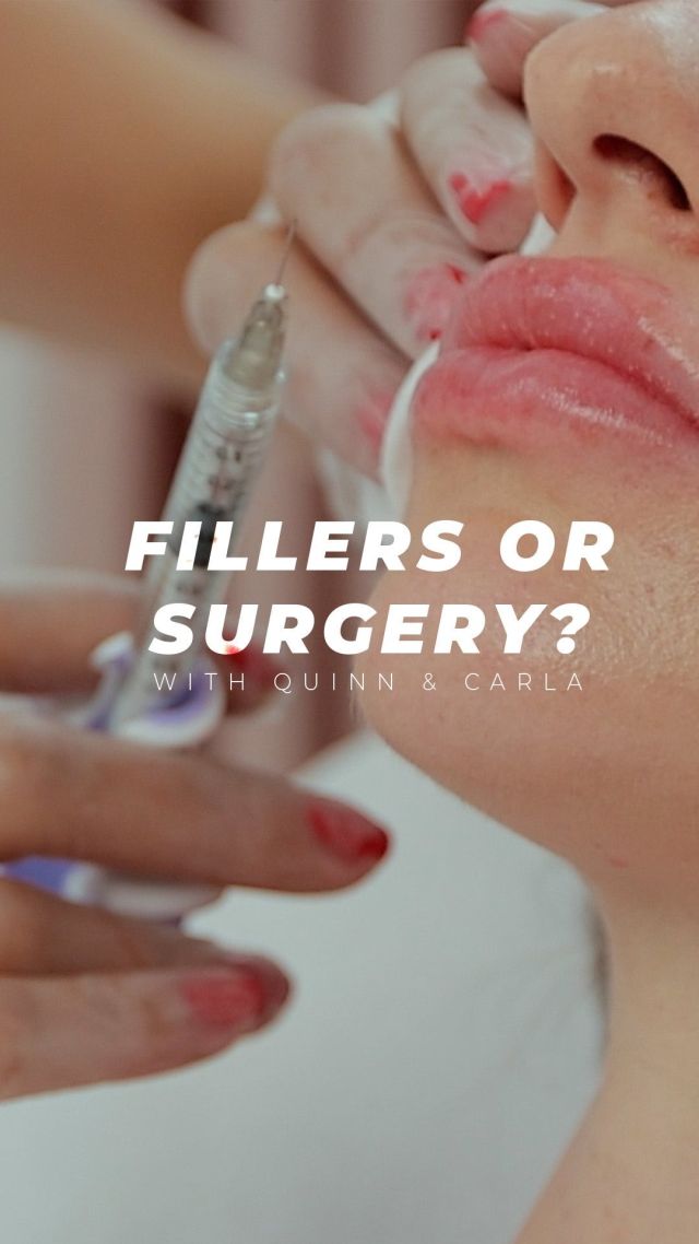 Fillers vs. Facelift: Choosing the Right Option 💉🌟// #aestheticsexpert 

Deciding between fillers and a facelift depends on your aesthetic needs. Our approach ensures a personalized consultation, providing honest evaluations to determine the best solution for you. We offer tailored solutions with realistic expectations, whether you’re starting with fillers or considering surgery. With our all-in-one care, you get comprehensive services from fillers to facelifts.

Fillers✨
✅Best for Mild Sagging: Ideal for early signs of aging.
✅Non-Surgical: Minimally invasive with little downtime.
✅Temporary Results: Last several months to a couple of years.

Facelift✨
✅For Advanced Sagging: Best for significant sagging.
✅Long-Lasting: Provides more permanent results.
✅Comprehensive: Addresses deeper skin layers for a natural lift.

👋BOOK NOW | You can book in-office or virtual appointments by sending your name, number, and email to the DM. 

📲 CALL US | questions regarding treatment: (310) 300-1779

📩Email: Info@drstoker.com

🛍 SHOP SKINCARE | Link in bio 🔗

COMMENT BELOW 🔽
.
.
.
.
#juvederm #botox #fillers #lipfiller #lips #restylane #beauty #filler #aesthetics #skincare #dermalfillers #lipfillers #lipinjections #antiaging #injectables #lipaugmentation  #medspa #juvedermlips #microneedling #voluma #lipenhancement #plasticsurgery #beforeandafter #dermalfiller #aesthetic #cheekfiller #prp #facelift