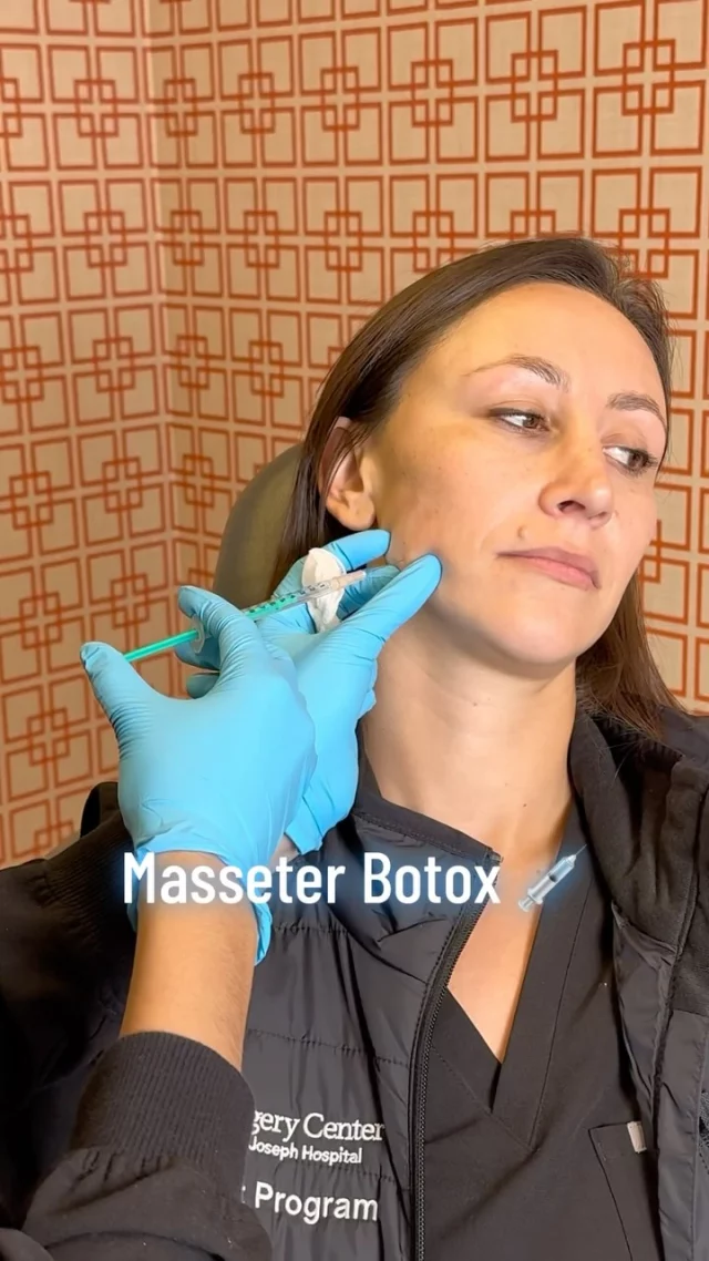 Masseter Botox for Jaw Slimming & TMJ Relief ✨ // #botox #tmj 

✅ Masseter Botox helps slim the jawline and relieve TMJ by relaxing the masseter muscle. It won’t create jowls, but by reducing muscle tension, it helps prevent skin from being pulled downward, maintaining a smoother, more youthful look. Perfect for those with TMJ or looking for subtle jawline contouring!

👋BOOK NOW | In-office or virtual appointments by sending your name, number, and email to the DM. 

📲 CALL US | questions regarding treatment: (310) 300-1779

📩Email: Info@drstoker.com

🛍 SHOP SKINCARE | Link in bio 🔗

COMMENT BELOW 🔽
.
.
.
.
#dermalfiller #botox #beauty #antiaging #aesthetics #fillers #undereyefiller #dermalfiller #medicalspa #juvederm #skin #lipfiller #injectables #plasticsurgery #facial #cheekfiller #lips #esthetician #aestheticsexpert #facials #dermalfillers #selfcare #microneedling #dysport #bodycontouring #restylane #laser #skincareroutine