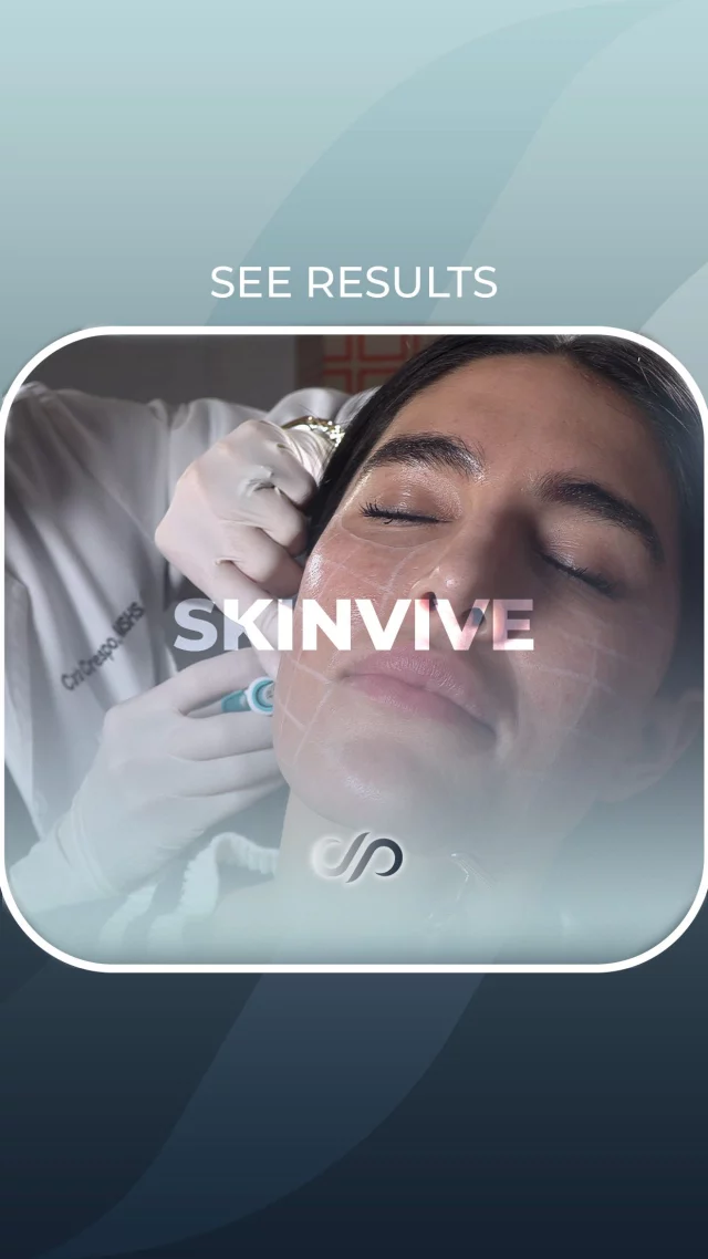 SKINVIVE™ by JUVÉDERM® ✨// #skinvive #juvederm #allergen 

💞Come in today and try out SKINVIVE™ by JUVÉDERM®, the first injectable of its kind in the US! It’s designed to add hydration directly into the skin, improving cheek skin smoothness and helping skin look healthy and glowing. This FDA-approved hyaluronic acid (HA) microdroplet injectable lasts for up to 6 months with optimal treatment. Don’t miss out!

BOOK NOW | In-office or virtual appointments by sending your name, number, and email to the DM. 

📲 CALL US | questions regarding treatment: (310) 300-1779

📩Email: Info@drstoker.com

🛍 SHOP SKINCARE | Link in bio 🔗

COMMENT BELOW 🔽
.
.
.
.
#juvederm #botox #fillers #lipfiller #lips #restylane #beauty #filler #aesthetics #skincare #dermalfillers #lipfillers #lipinjections #antiaging #injectables #allergan #medspa #microneedling #voluma #lipenhancement #plasticsurgery #beforeandafter #dermalfiller #aesthetic #russianlips #cheekfiller